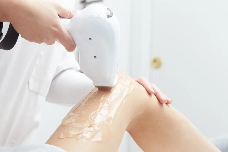 laser-hair-removal (4)
